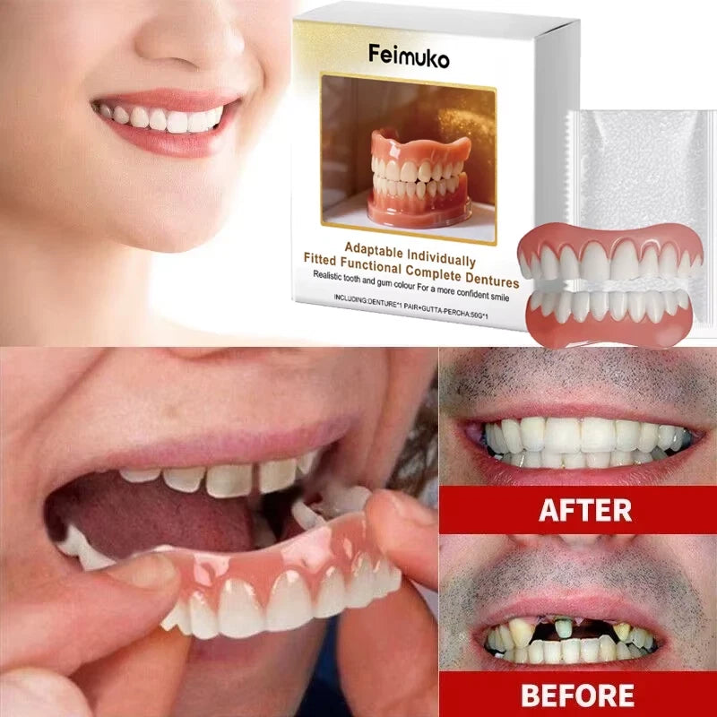 New Denture Silicone Kit - Soft Kit Teeth Upper and Lower Set - Silicone Liners